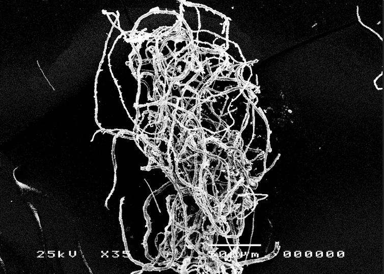 Electron microscope image of plastics recovered from stomachs of Scottish langoustine. Natalie Welden 