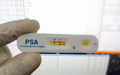 Person holding a Prostate Specific Antigen rapid test cassette showing a positive result