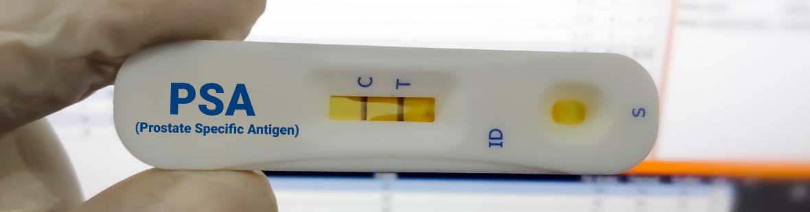 Person holding a Prostate Specific Antigen rapid cassette showing a positive result