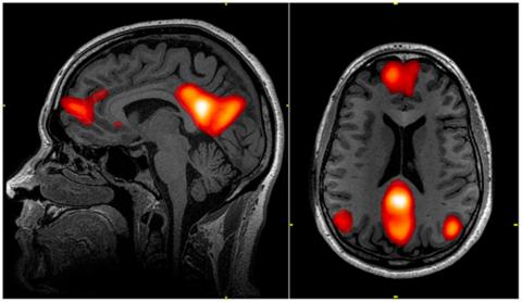 Functional magnetic resonance imaging could reveal whether someone knows something they’re not telling. 