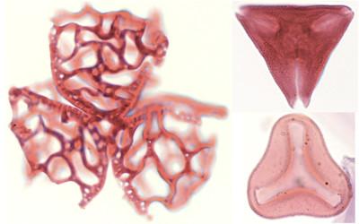 Microscopic sections of three different types of pollen grains