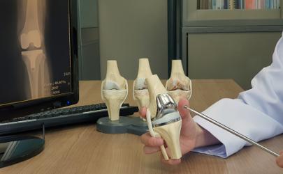 Knee replacement joints 
