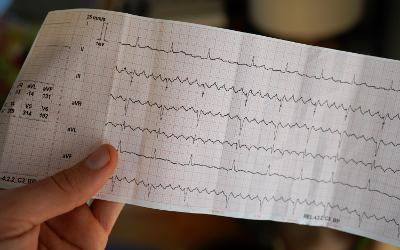 Hand holding an electrocardiogram